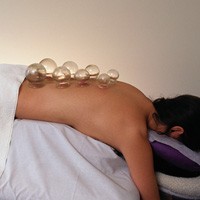 Chinese Medicine Cupping - Person on the table with glass bowls on their back